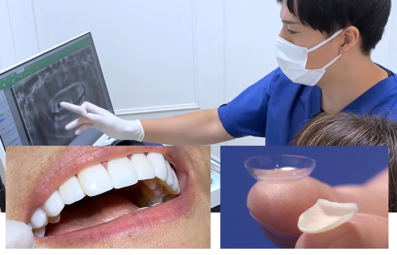 サムネイル画像